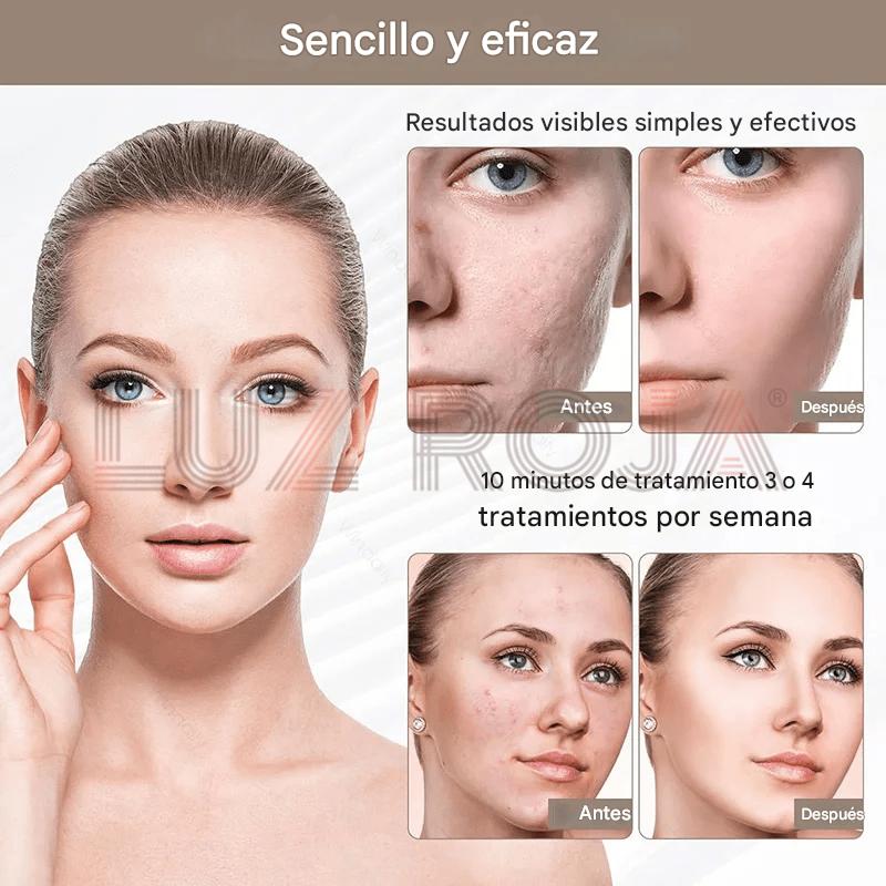 Máscara LED Terapia Facial 7 Tratamientos de color