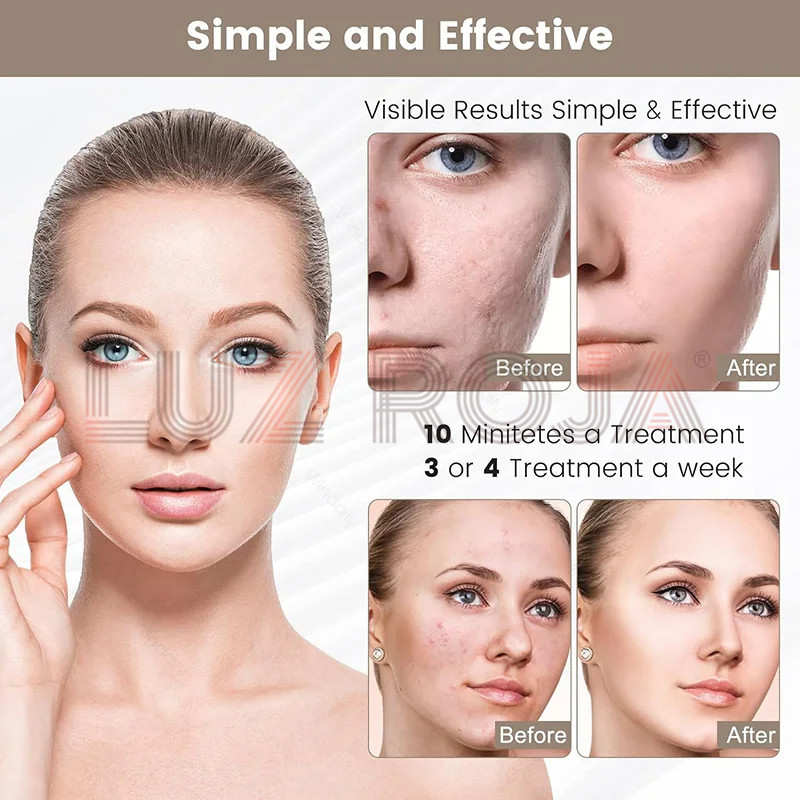 Máscara LED Terapia Facial 7 Tratamientos de color